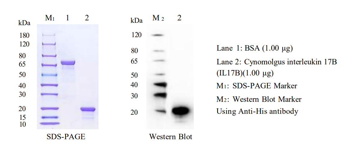 SDS-PAGE results of GM-Tg-cynog-IO076-Ag-1