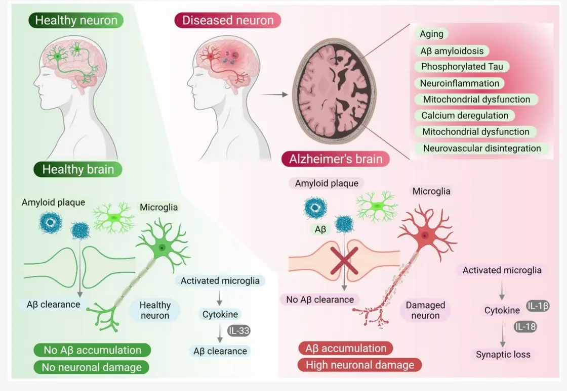 Microfluidic Platforms to Unravel Mysteries of Alzheimer's Disease